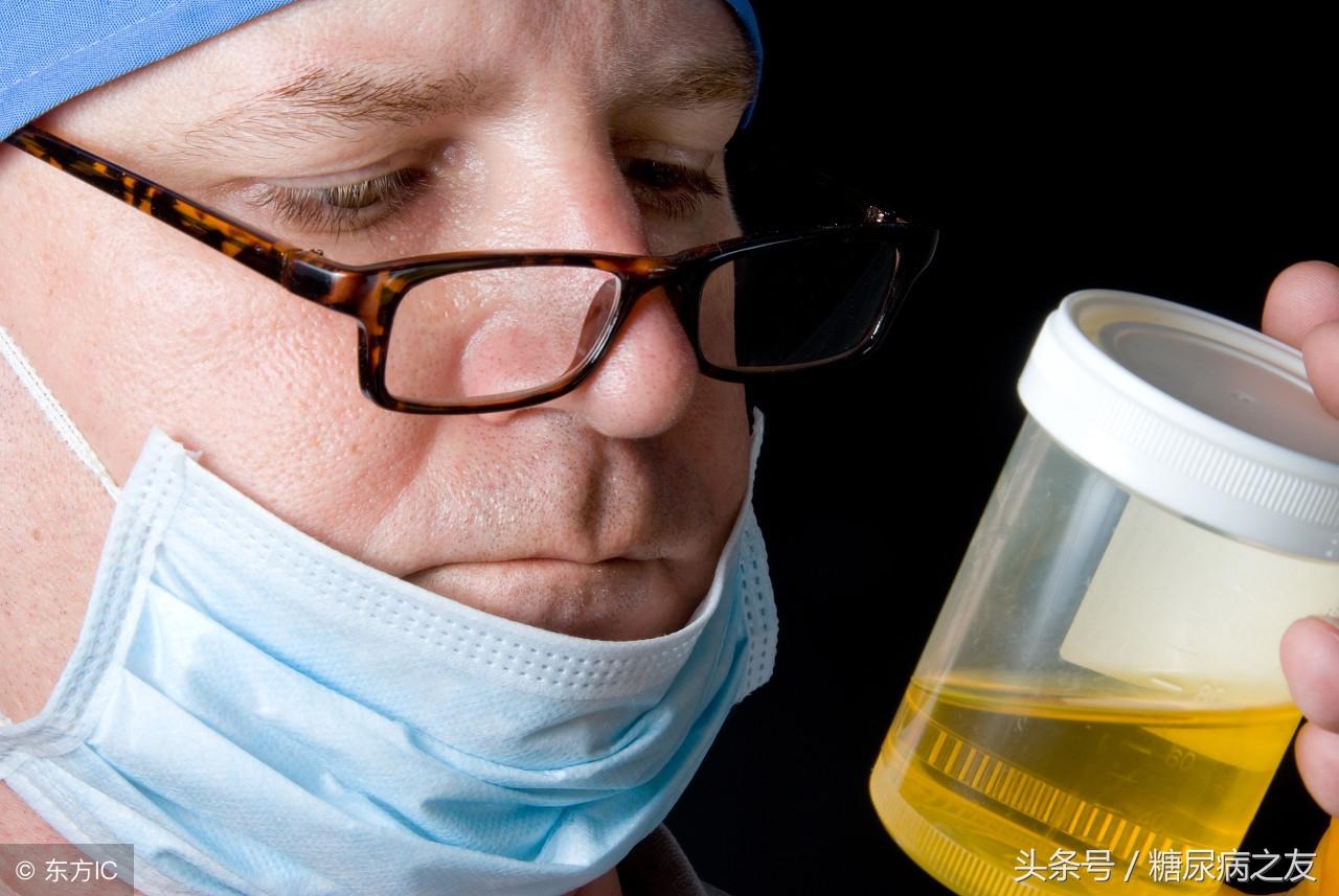 尿常規(guī)檢查價格，微小投資開啟健康自信之門