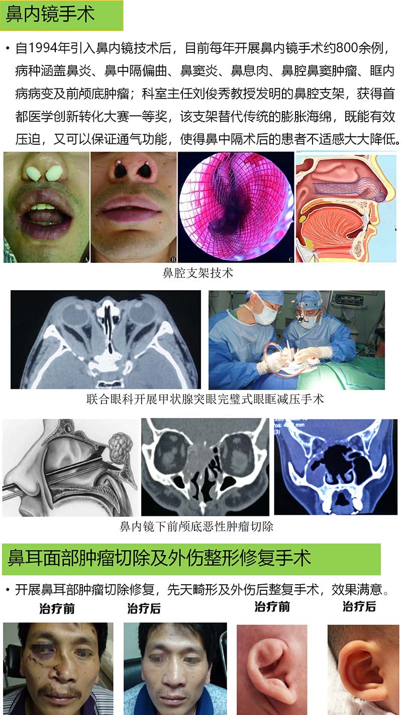 鼻息肉最新手術(shù)治療步驟詳解，權(quán)威指南